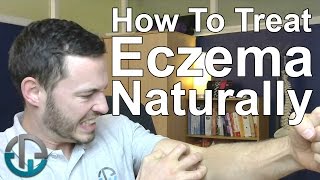 How To Treat Eczema Naturally [upl. by Ralaigh]