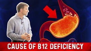 Vitamin B12 Deficiency The most common Cause – Dr Berg [upl. by Aneema]