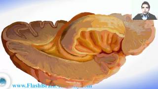 Brain Ventricles Anatomy And Insular Cortex [upl. by Nibot]