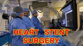 Heart Stent Surgery [upl. by Latin144]