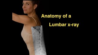 Anatomy of a Lumbar xray [upl. by Travis462]