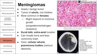 Nervous System Tumors [upl. by Ellecram782]